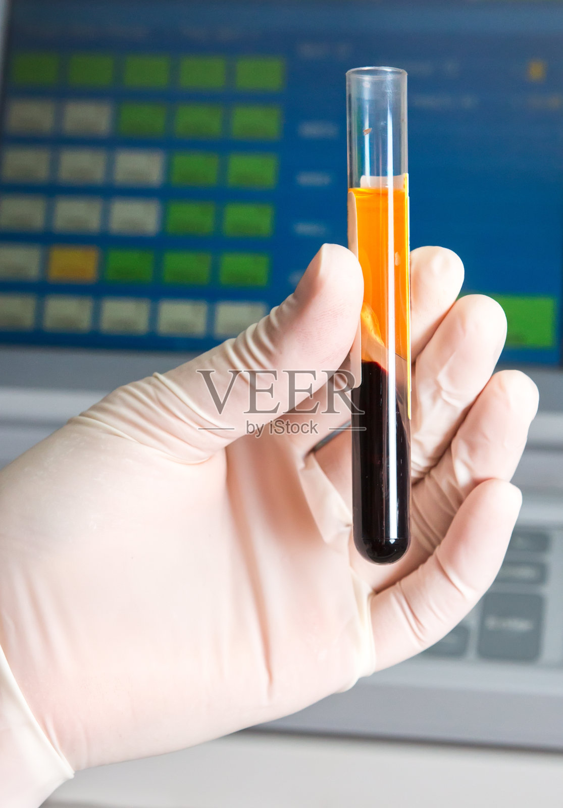 沃森生物：已获肠道微生物技术独占权