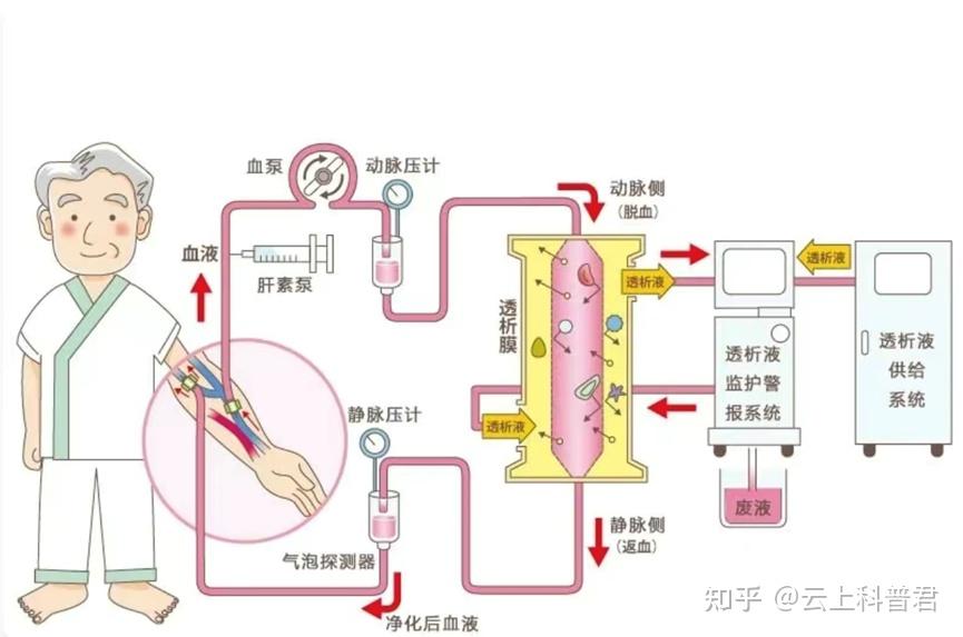血液净化技术：血浆置换行业2025年发展前景预测_人保车险   品牌优势——快速了解燃油汽车车险,人保有温度
