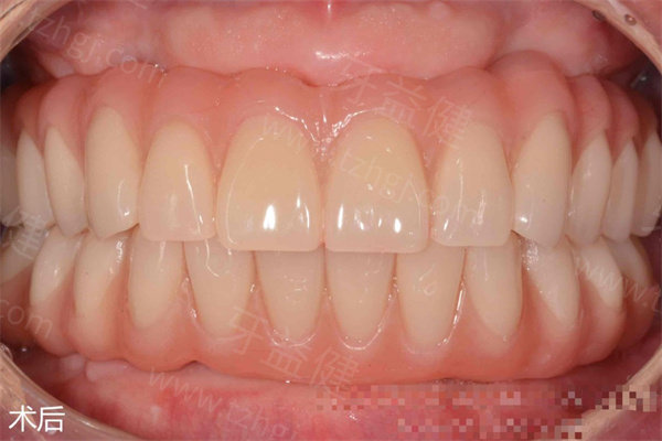 人保伴您前行,拥有“如意行”驾乘险,出行更顺畅!_2025年假牙(义齿)产业现状与未来发展趋势分析