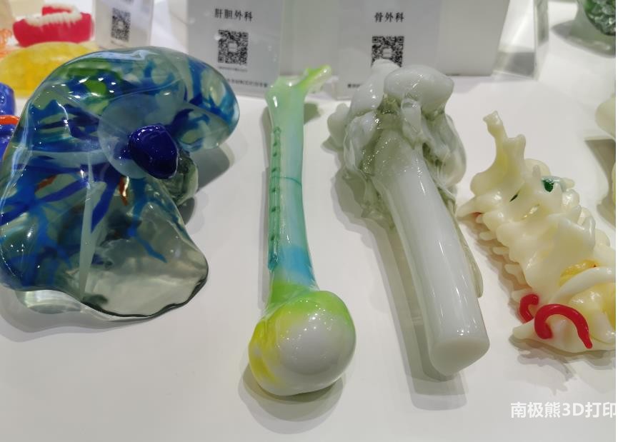 榕基软件获得发明专利授权:“一种多视角3D骨骼实时重建方法及存储介质”