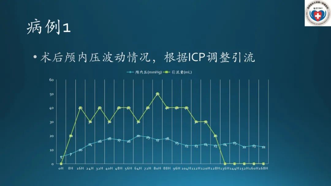 超研股份：超声在颅脑应用已获多项专利