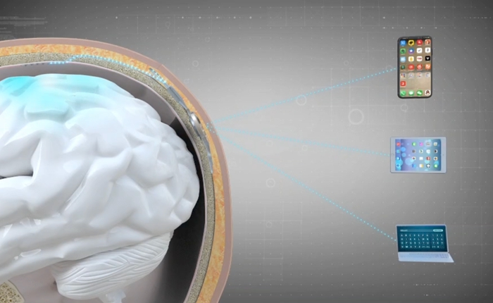 信邦制药：下属医院未涉及脑机接口植入医疗服务