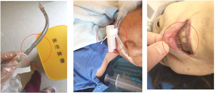 美德乐获得实用新型专利授权:“一种防护网快拆结构”